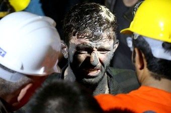 Somada Ki Facia, Canımızı Yaktı!